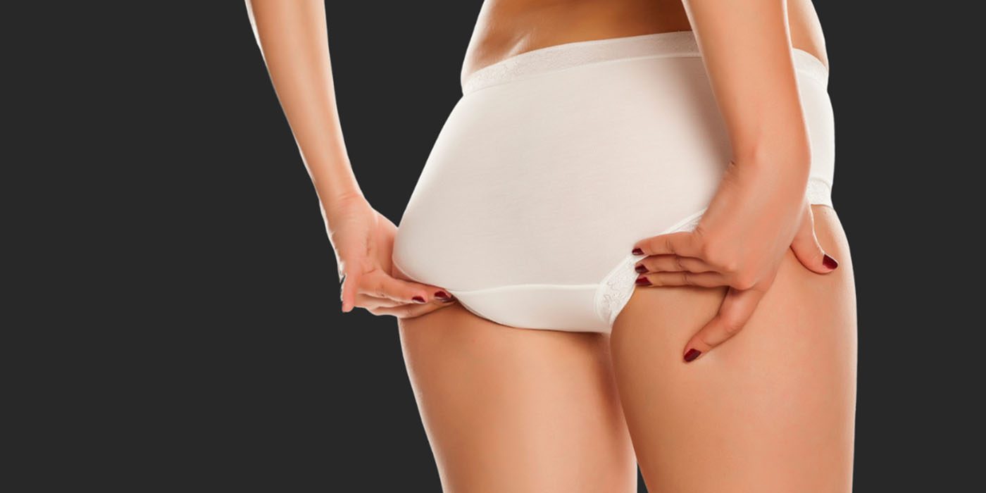 SurgiSculpt mini tummy tuck scar