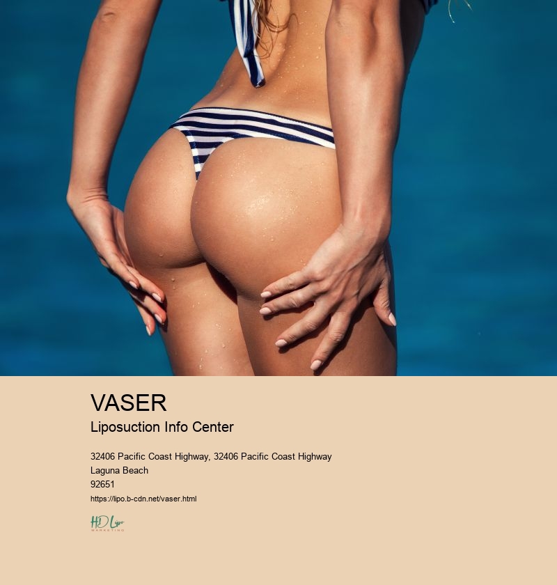 VASER